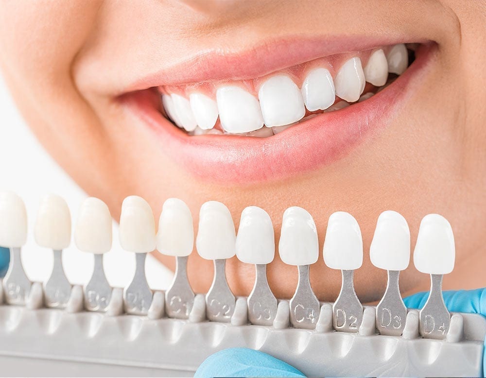 Woman Checking Veneers